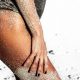 Gluteoplastia y alternativas